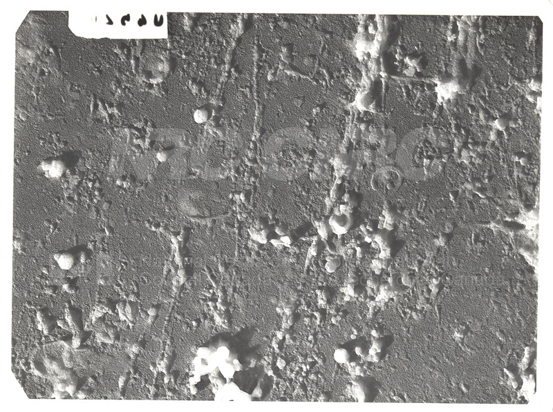 Electron Microscope Image of _